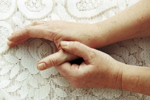 Thumb Arthritis care at Panorama Ortho