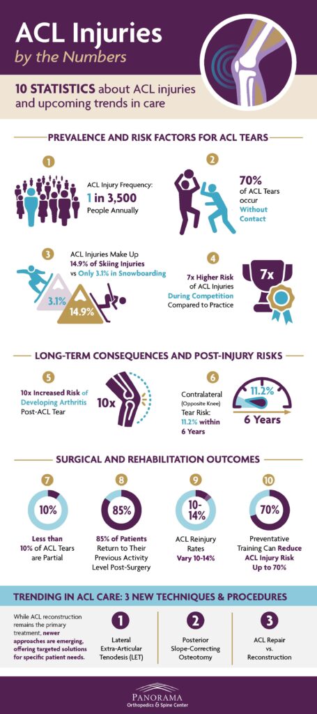 Infographic with statistic about ACL injuries.